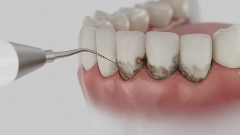 Trusted Wisdom Tooth Removal service in Sterling, GA - Dentist Open Now